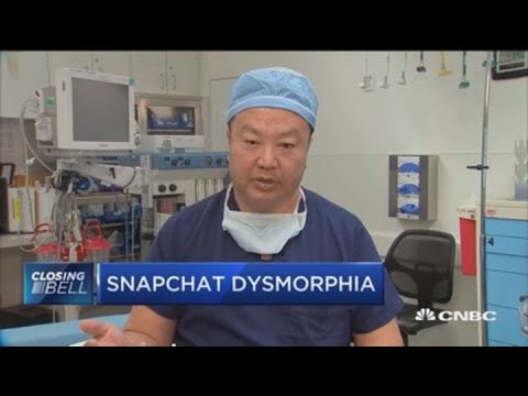 Snapchat dysmorphia: Increase in patients seeking Snapchat filter look