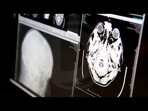 A Killer&#039;s Brain: Scans Look for Clues to Violence